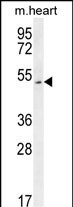 1 - SLC10A4 Antibody (C-term) AP10250b
