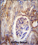 14 - DYNLRB2 Antibody (Center) AP10258C