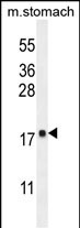 1 - DYNLRB2 Antibody (Center) AP10258C