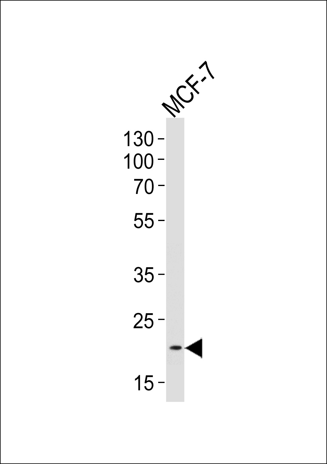 1 - NOS1AP Antibody (Center) AP10269c