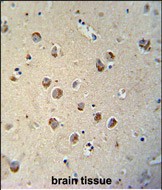 14 - TECTB Antibody (N-term) AP10280A