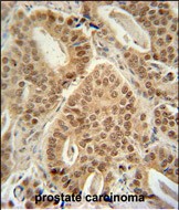 14 - ZNF595 Antibody (C-term) AP10304b