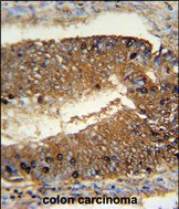 14 - NSUN7 Antibody (C-term) AP10307b