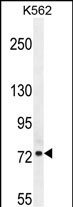 1 - NSUN7 Antibody (C-term) AP10307b