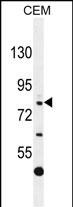 1 - C11orf63 Antibody (C-term) AP10323b