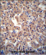 14 - ATPBD3 Antibody (Center) AP10349C