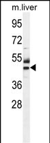 1 - ATPBD3 Antibody (Center) AP10349C