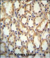 14 - KCNT2 Antibody (C-term) AP10351b