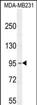 1 - KCNT2 Antibody (C-term) AP10351b