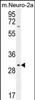 1 - TMEM65 Antibody (N-term) AP10360a