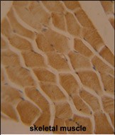 14 - LMOD2 Antibody  (N-term) AP10364a