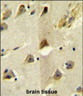 14 - SLC12A5 Antibody (N-term) AP5876a