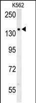 1 - SLC12A5 Antibody (N-term) AP5876a