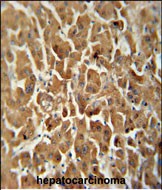14 - ATP5G2 Antibody (C-term) AP5906b