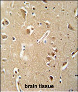 14 - CILP2 Antibody (Center) AP5907c