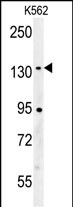 1 - CILP2 Antibody (Center) AP5907c