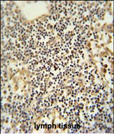 14 - TMUB1 Antibody  (Center) AP5928c