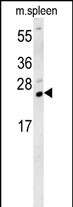 1 - TMUB1 Antibody  (Center) AP5928c