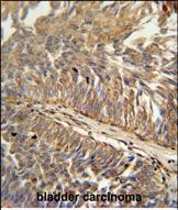 14 - ATP13A3 Antibody (N-term) AP5938a