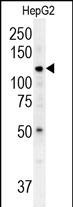 1 - ATP13A3 Antibody (N-term) AP5938a