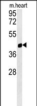 1 - PTGR1 Antibody  (Center) AP5941C