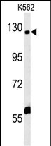 1 - IQSEC3 Antibody (N-term) AP5974a