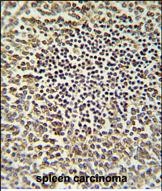 14 - CARD9 Antibody (N-term) AP5985a