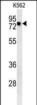 1 - CARD9 Antibody (N-term) AP5985a