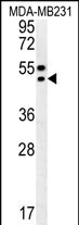 1 - TRAM2 Antibody (C-term) AP5996b