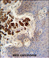 14 - COL19A1 Antibody (N-term) AP10475A