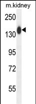 1 - COL19A1 Antibody (N-term) AP10475A