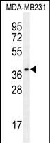 1 - PRSS3 Antibody (N-term) AP10489a