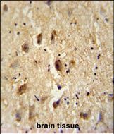 14 - VITRN Antibody  (C-term) AP10507b