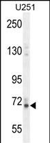 1 - VITRN Antibody  (C-term) AP10507b