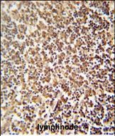 14 - ZNF98 Antibody  (C-term) AP10523b