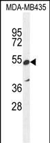 1 - ZNF98 Antibody  (C-term) AP10523b
