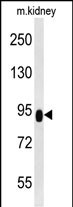 1 - ZBTB41 Antibody (Center) AP10544c