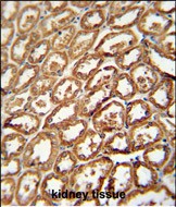 14 - DEGS2 Antibody (C-term) AP10582B