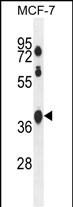 1 - SPATA2L Antibody (Center) AP10584c