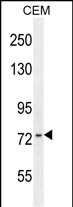 1 - ZNF493 Antibody (C-term) AP10602b
