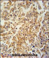 14 - TEX9 Antibody (N-term) AP10612a