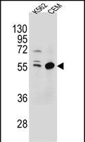 1 - TEX9 Antibody (N-term) AP10612a