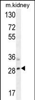1 - TIGIT Antibody (C-term) AP10616b