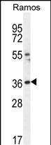 1 - TIGIT Antibody (C-term) AP10616b