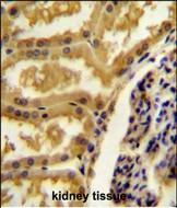 14 - CRIP3 Antibody (Center) AP10618c