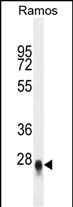 1 - CRIP3 Antibody (Center) AP10618c