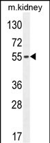 1 - FBXO39 Antibody (C-term) AP10627b