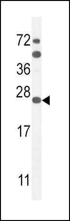 1 - SCN1B Antibody (N-Term) AP10645A