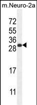 1 - BHLHA15 Antibody (C-term) AP10649B