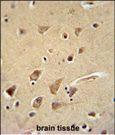 14 - GPC5 Antibody (N-term) AP10678a